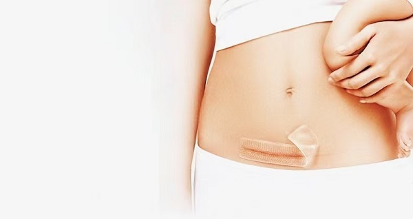 ເປັນຫຍັງແຜ່ນເຈວຊິລິໂຄນໜາຈຶ່ງເປັນທີ່ນິຍົມ?