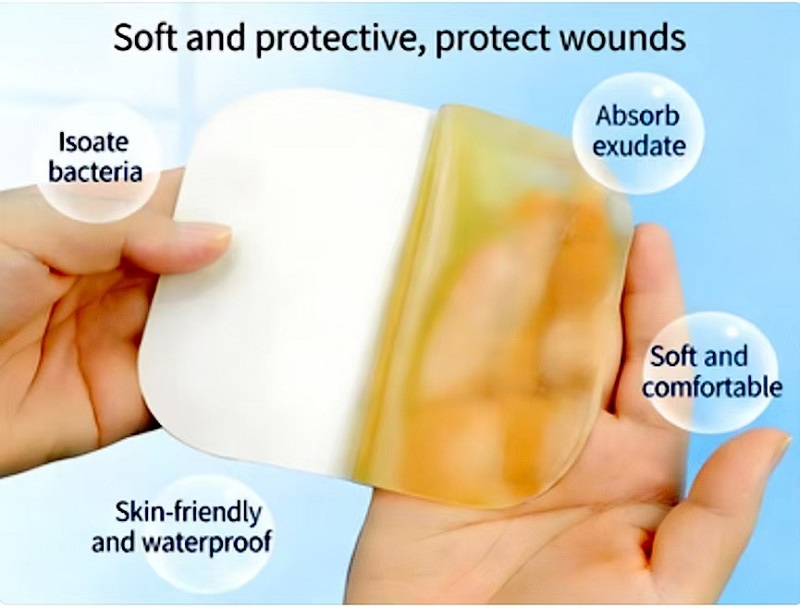 Hydrocolloid Dressings: ເປັນທາງເລືອກໃຫມ່ສໍາລັບການດູແລບາດແຜ