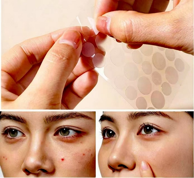 ໃຊ້ CmallBio Pimple Patches ຂ້າມຄືນເພື່ອໃຫ້ໄດ້ຜົນສູງສຸດບໍ?