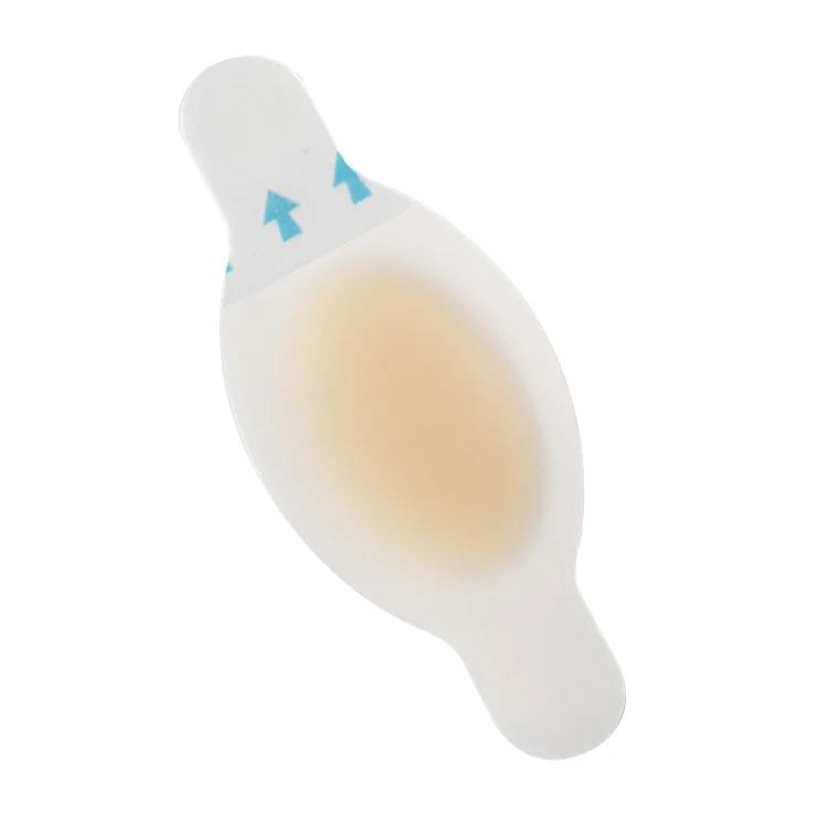 ຜ້າພັນບາດ Hydrocolloid ທົນທານຕໍ່ນ້ໍາສໍາລັບການປ້ອງກັນການຕຸ່ມຜື່ນຕີນ